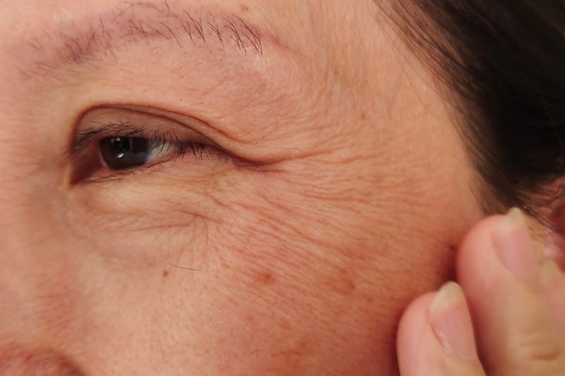 しわ・小じわでお悩みの方へ