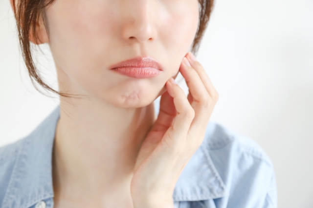 しわやボリュームのお悩みに応える