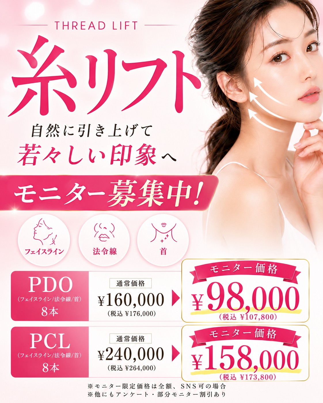 糸リフト