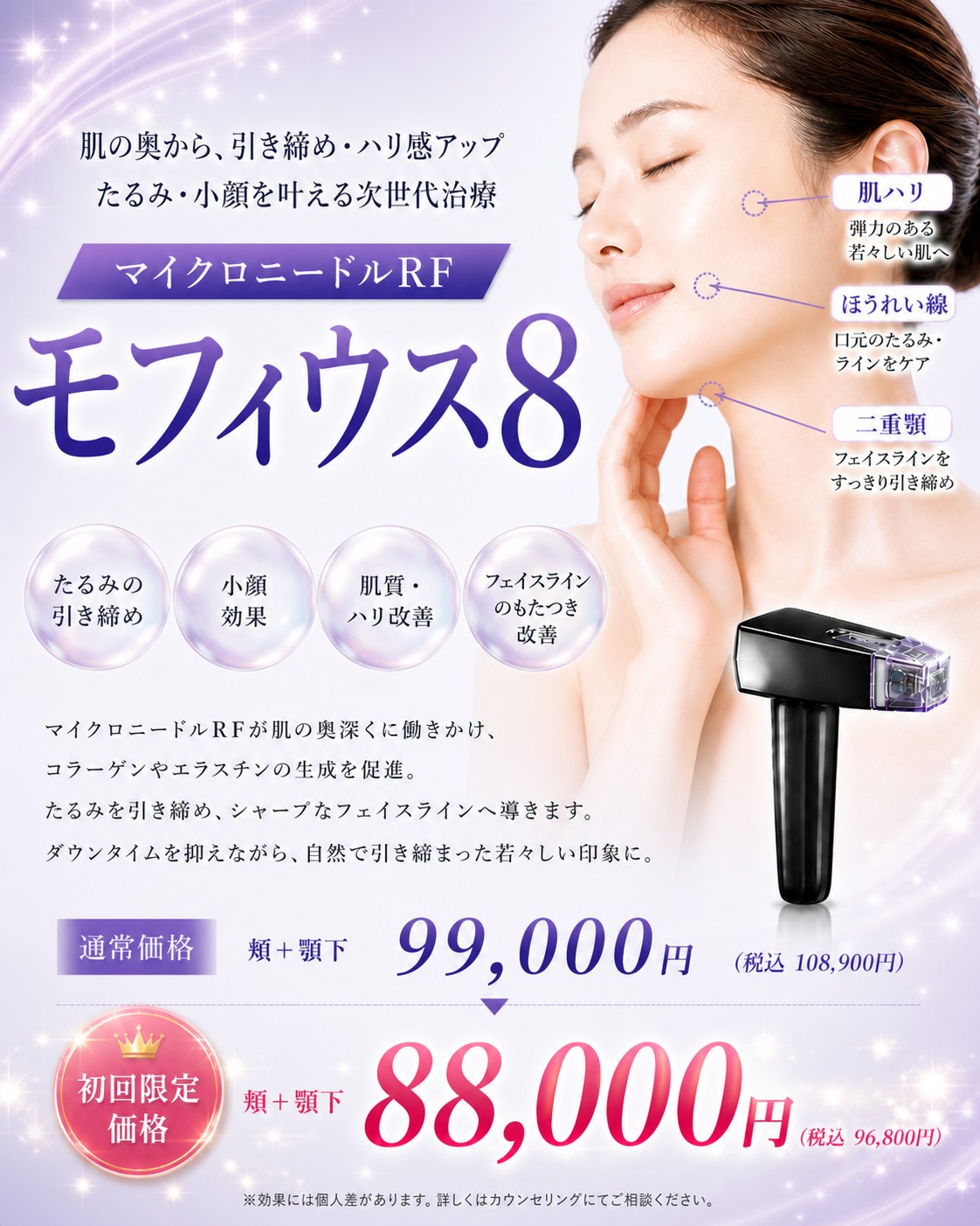 モフィウス8